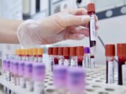 Hiv, dalla Sicilia il modello per estendere terapie long acting