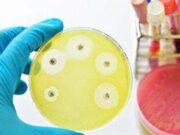 Ai e medicina di precisione per combattere super batteri resistenti, lo studio italiano su quasi 10.000 pazienti