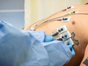 Caldo, disidratazione e sbalzi pressori: ecco le 10 regole per proteggere la salute del cuore